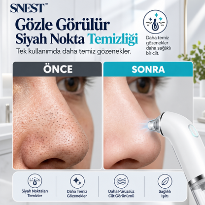 SNEST™ AquaGlow Pro | Vakumlu Gözenek Temizleme & Cilt Bakım Cihazı